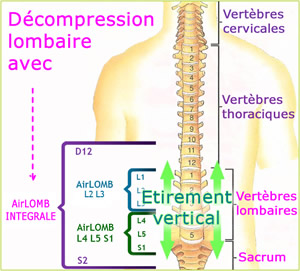 Tableau montrant les zonnes de décompression lombaire fournies par  AirLOMB