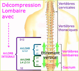 les ceintures airlomb positionnées selon notre squelette