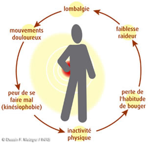 les douleurs lombaires, le mal du siècle