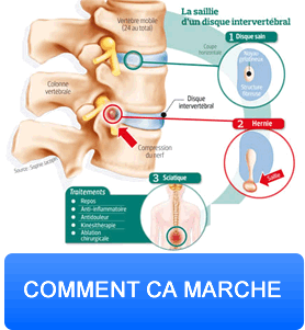 btn-pathologie-disques-intervertebraux